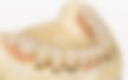 江苏泰州姜堰鹏程口腔的价格收费