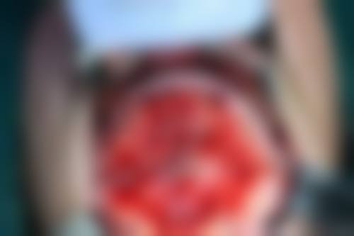 浙江杭州维信口腔的价格收费