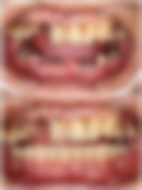 渭南景琳娜口腔诊所技术优势