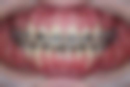 罗柏柯的临床实战与个性化诊疗