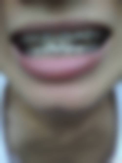 程玲的学术积累与诊疗把控