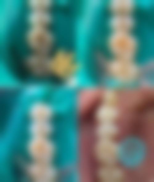 李彦玲的临床实战与个性化方案