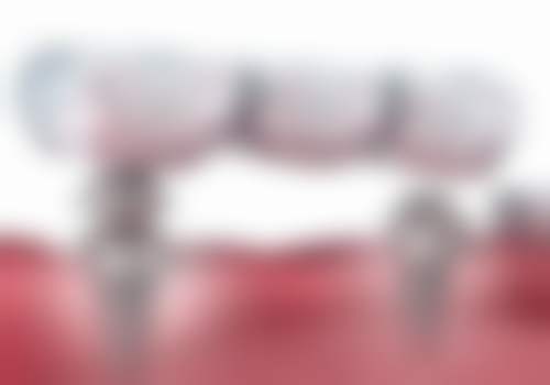 方稚荣的诊疗标准与服务细节