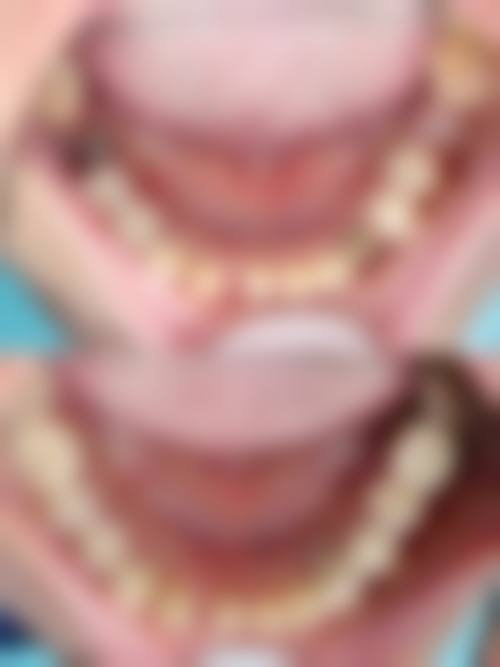 荣成一诺口腔特色诊疗技术