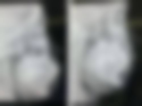 朱雅丽的临床实战与真实实例