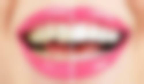 杭州好牙口腔来院指南