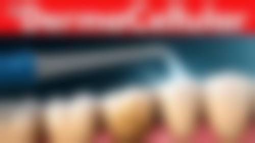 武俊英医生温馨科普:口腔诊疗术前准备要点