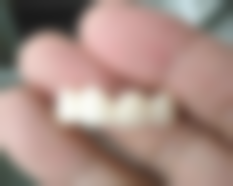 杭州好牙口腔收费价格明细