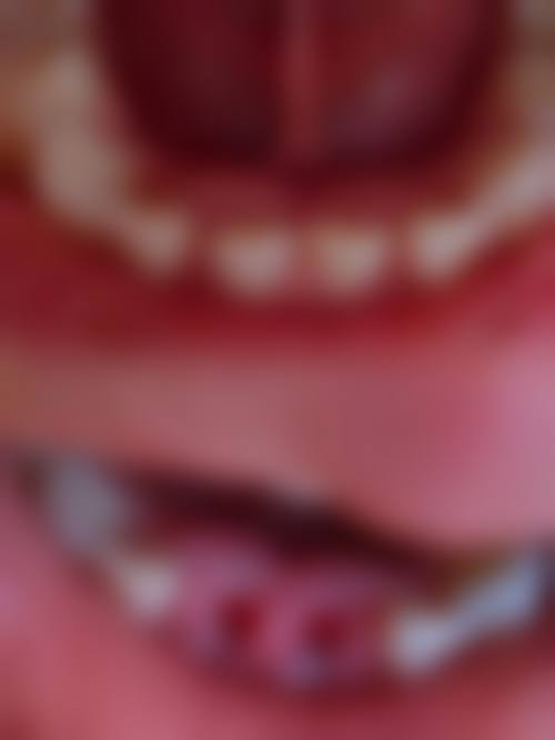 哈尔滨牙博士口腔门诊部特色诊疗技术