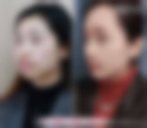 莫三心的价格与就诊指引