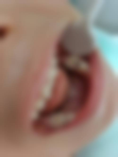 云南昆明爱牙口腔门诊部的特色诊疗技术