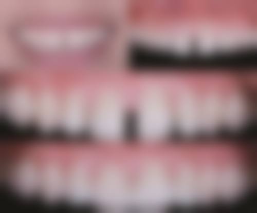 上海瑞欧齿科(瑞欧华 山路店)收费价格参考