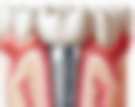 菏泽恒贝口腔万达店来院就诊指南