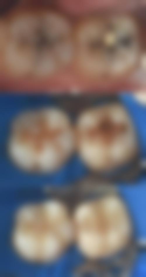 淮南曹品霞口腔诊所价格收费标准