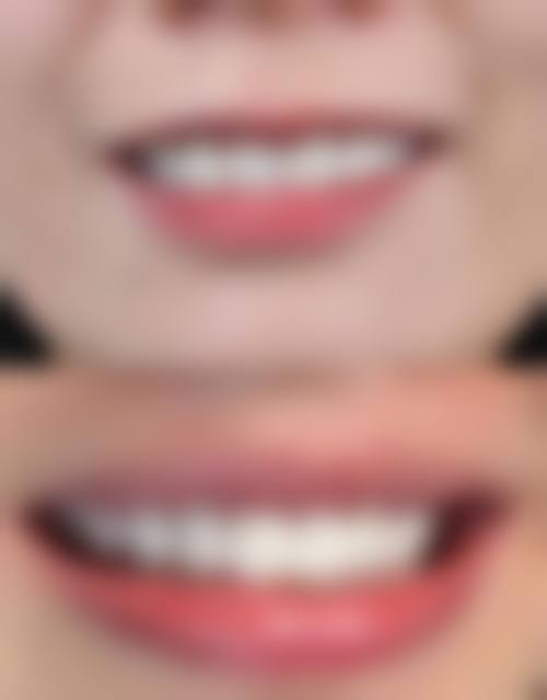 金华浦江金淑珍口腔收费价格明细