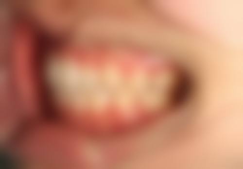 宗秋的临床实战与个性化方案