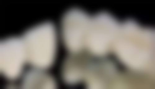 耒阳博雅口腔诊所患者真实评价