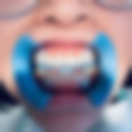 山东临沂沂水沂博士口腔门诊部透明收费标准