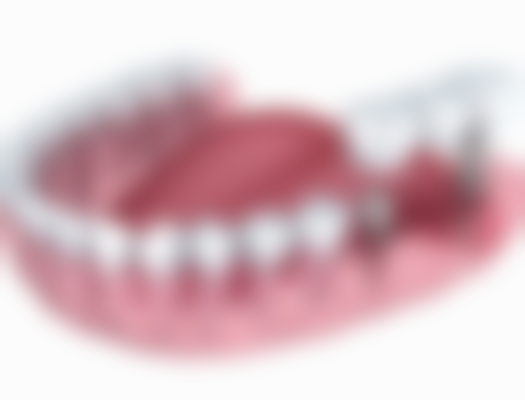 温州瑞安柯宗武口腔就诊指南