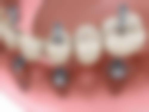 成都简阳柏贝口腔医院医生团队实力