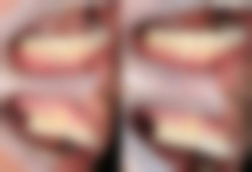 江苏泰州靖江陈玉川口腔来院与预约指南