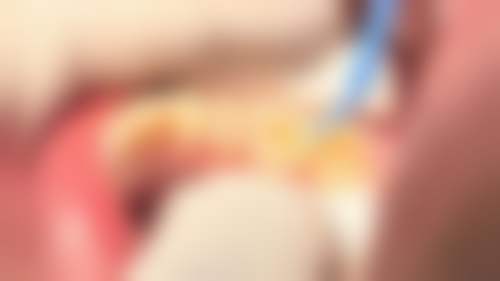 宗秋 的临床实战与个性化诊疗