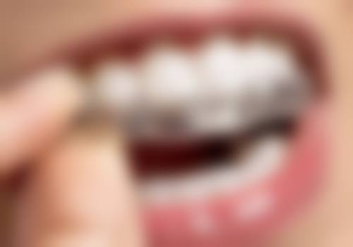 上海瑞申口腔门诊部收费价格参考