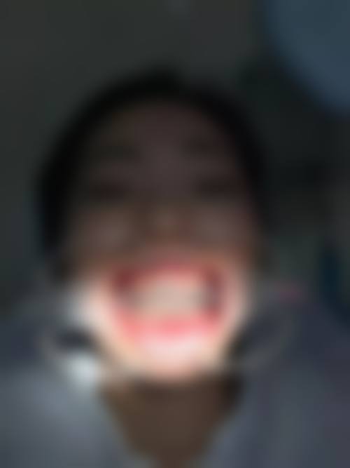 惠州源泉口腔收费参考标准