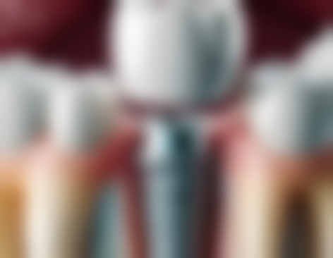 四平铁西美蒂斯口腔诊所来院指引