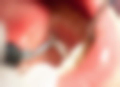 三亚周春霞口腔诊所患者真实评价