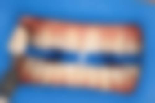 江西吉安皓靓口腔门诊部项目覆盖与口碑实力