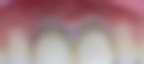 防城齿康口腔的患者真实口碑