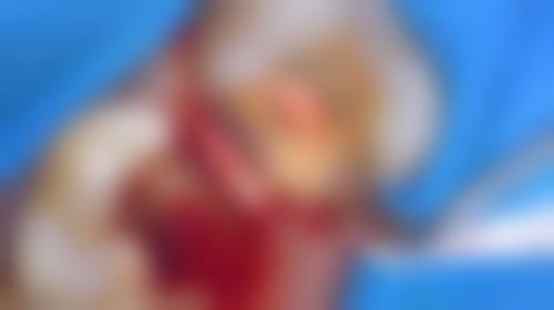 陕西渭南合阳县小虎牙口腔透明收费标准