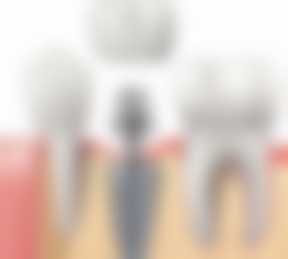 广州亿嘉口腔门诊部透明化收费标准