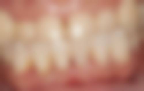 天津市河西医院口腔科特色诊疗技术