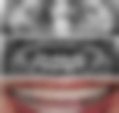 天津医博口腔门诊部患者真实评价