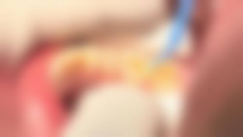 广西玉林恒兴口腔连锁就诊指南