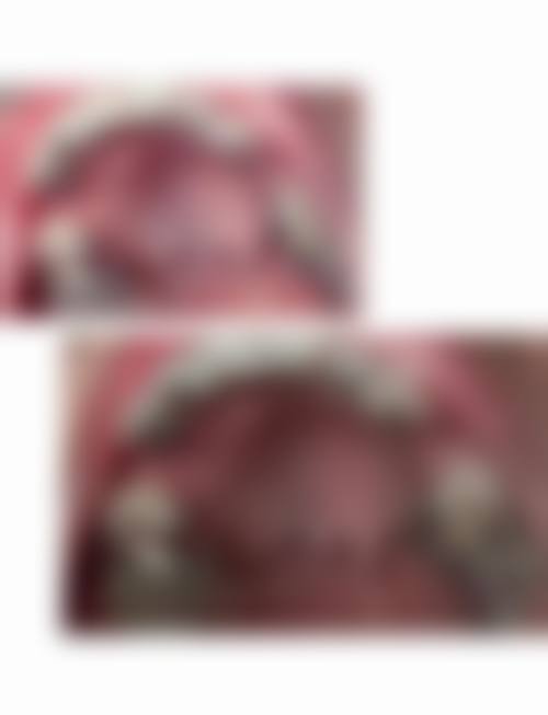 广西玉林恒兴口腔连锁特色诊疗技术