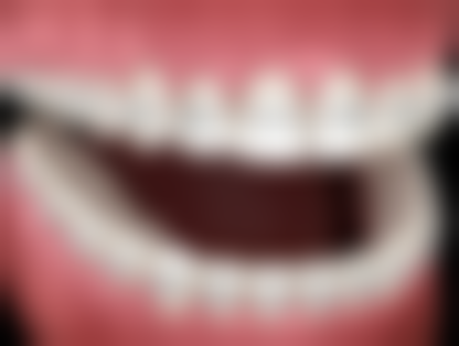 兴国县雅美口腔医院患者真实评价