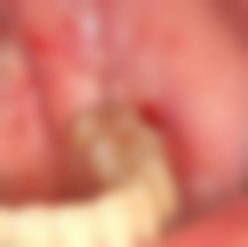 平顶山湛河益齿宁口腔收费参考标准