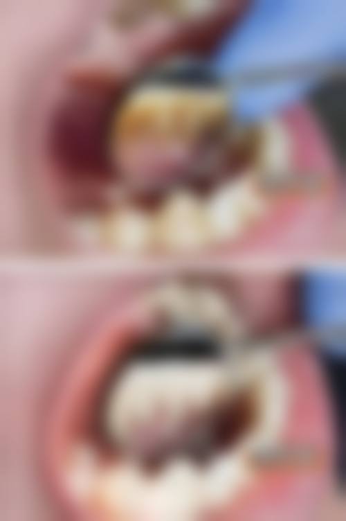 覃政霖的临床实战与个性化诊疗