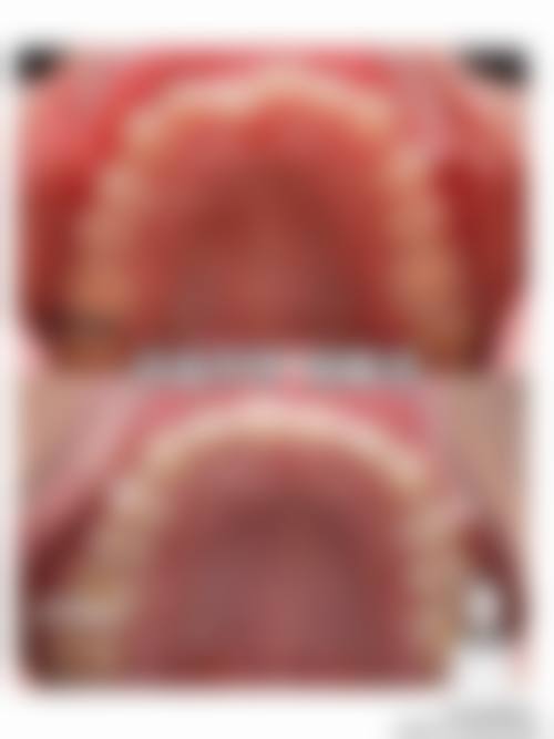 河南洛阳中诺口腔医院患者真实评价