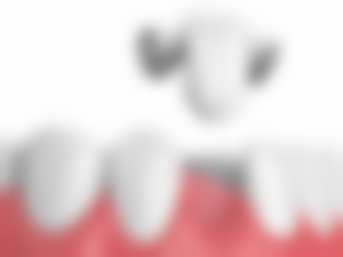 江苏连云港普爱口腔特色诊疗技术