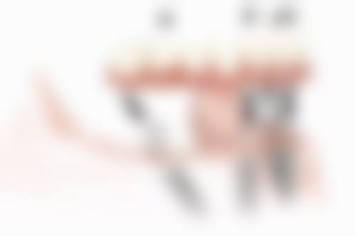 江苏连云港普爱口腔患者真实评价