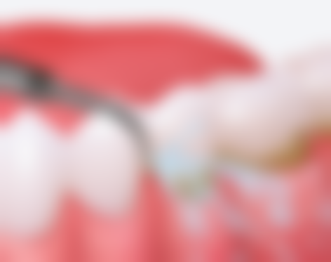 荆州咿呀口腔收费标准参考