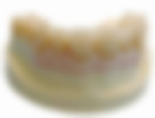 郑州蓝璞口腔门诊部收费价格参考