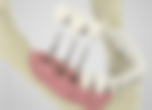 河北石家庄圣熙口腔特色诊疗项目