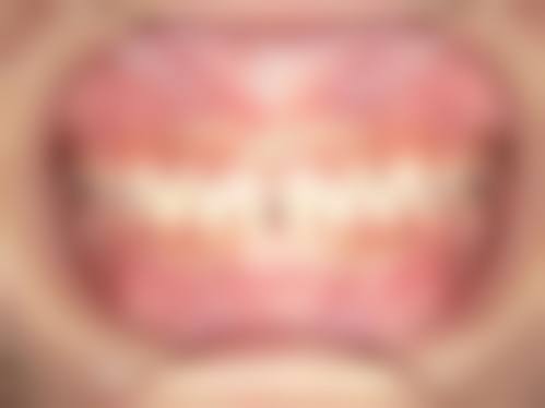 黄亚婵的价格收费与就诊指引