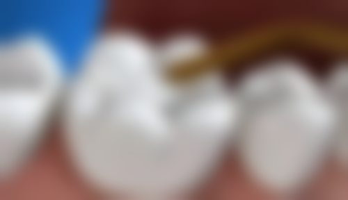 湖北襄阳维乐口腔门诊部就诊服务与体验