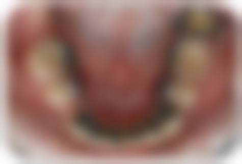 常州美奥口腔收费标准说明